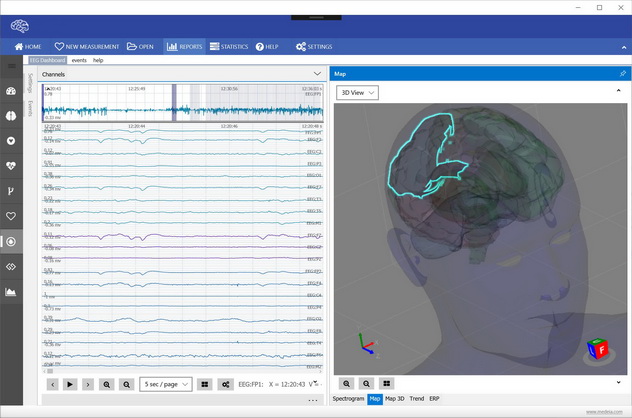 brain mapping in personal injury cases